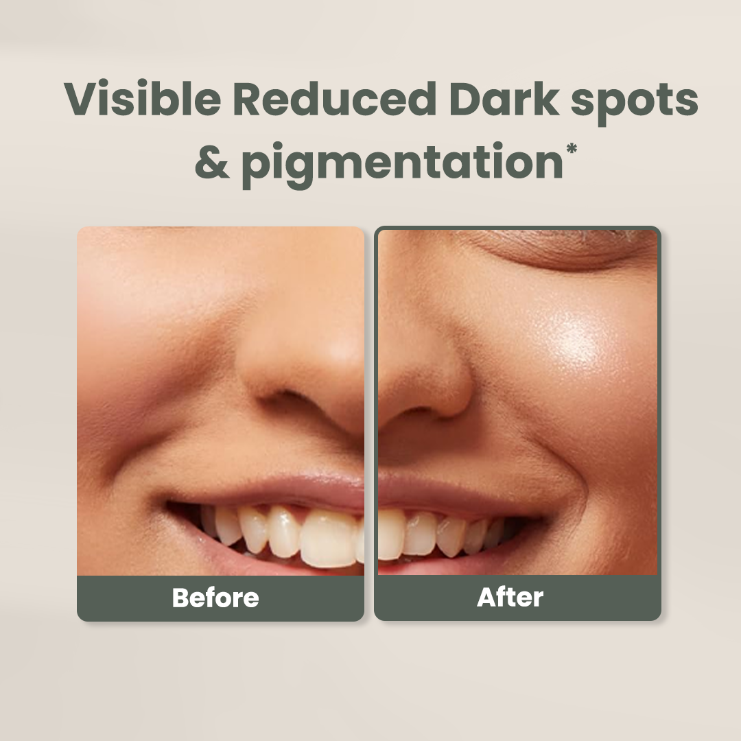 Silken Rice Moisturizer (Rice water  +Hyaluronic Acid +ceramide moisturiser)