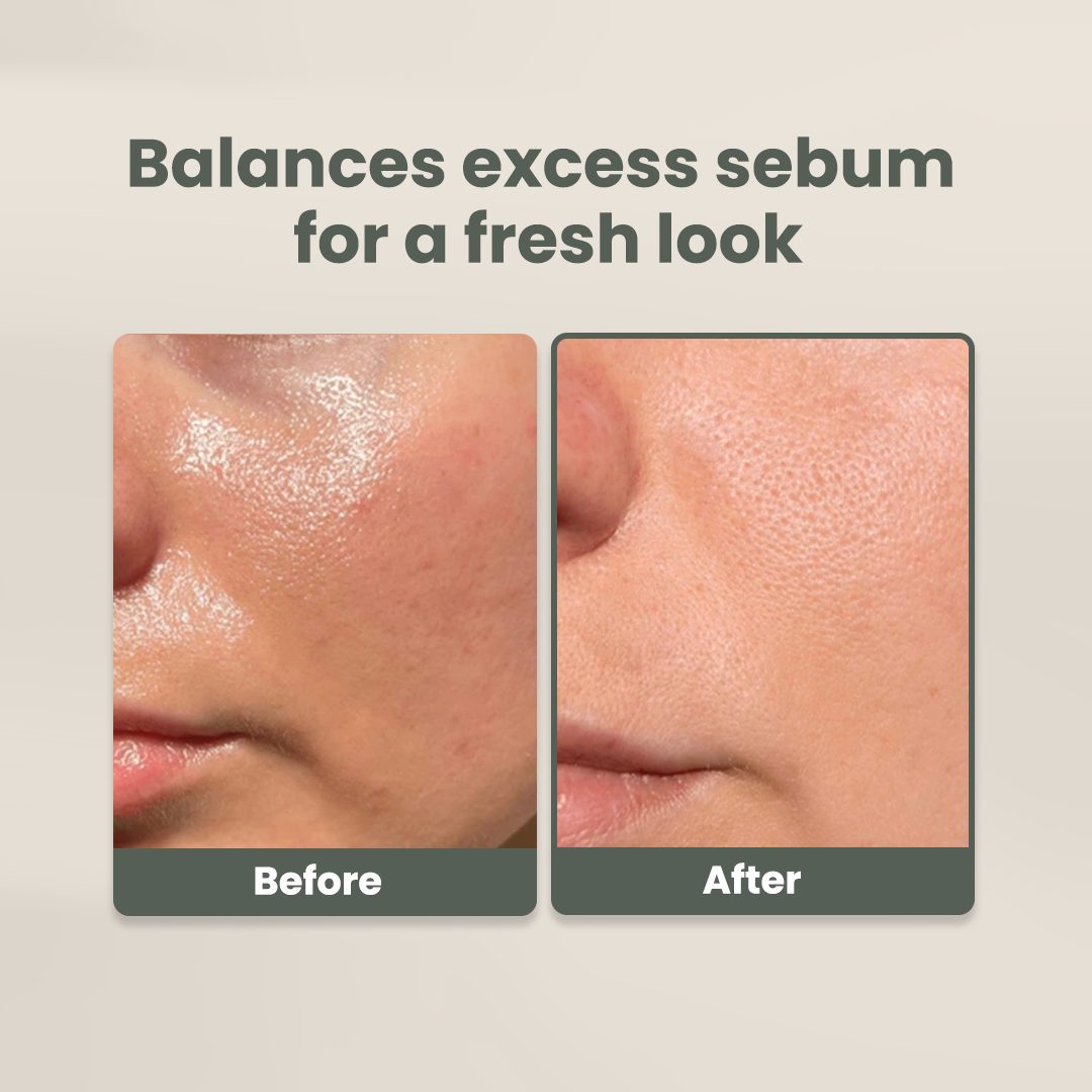 Pure Balance Face Wash (Niacinamide Oil & Acne Control Cleanser)