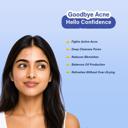 Oily & Acne Control Face Wash